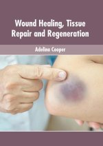Wound Healing, Tissue Repair and Regeneration