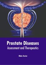 Prostate Diseases: Assessment and Therapeutics