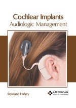 Cochlear Implants: Audiologic Management