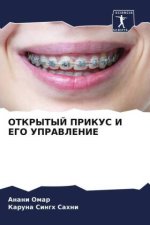 OTKRYTYJ PRIKUS I EGO UPRAVLENIE