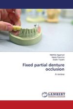 Fixed partial denture occlusion