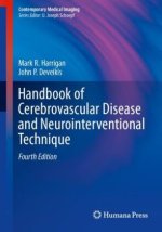 Handbook of Cerebrovascular Disease and Neurointerventional Technique