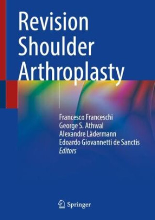 Revision Shoulder Arthroplasty