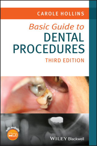 Basic Guide to Dental Procedures, 3rd Edition