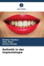 Ästhetik in der Implantologie