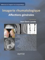 Imagerie musculosquelettique