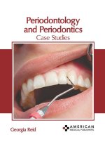 Periodontology and Periodontics: Case Studies