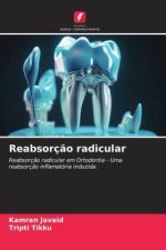 Reabsorç?o radicular