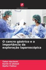 O cancro gástrico e a importância da exploraç?o laparoscópica