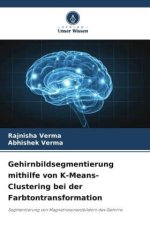 Gehirnbildsegmentierung mithilfe von K-Means-Clustering bei der Farbtontransformation