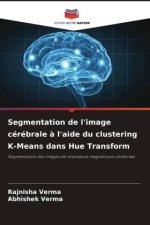 Segmentation de l'image cérébrale ? l'aide du clustering K-Means dans Hue Transform