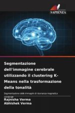Segmentazione dell'immagine cerebrale utilizzando il clustering K-Means nella trasformazione della tonalit?