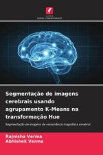 Segmentaç?o de imagens cerebrais usando agrupamento K-Means na transformaç?o Hue