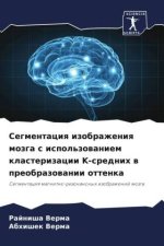 Segmentaciq izobrazheniq mozga s ispol'zowaniem klasterizacii K-srednih w preobrazowanii ottenka