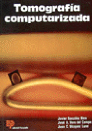 TOMOGRAFIA COMPUTARIZADA