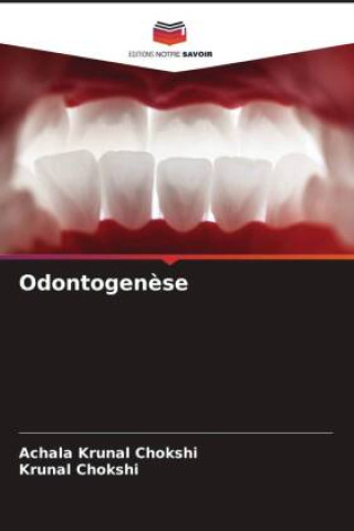 Odontogen?se