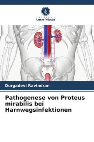 Pathogenese von Proteus mirabilis bei Harnwegsinfektionen