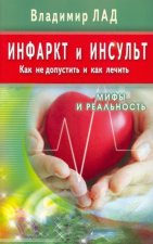 Инфаркт и инсульт.Как не допустить и как лечить.Мифы и реальность