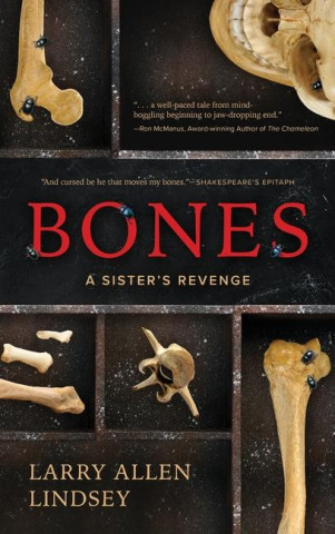 Bones