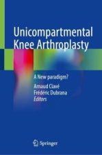 Unicompartmental Knee Arthroplasty