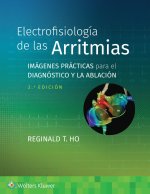 ELECTROFISIOLOGIA DE LAS ARRITMIAS.