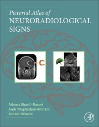 Pictorial Atlas of Neuroradiological Signs