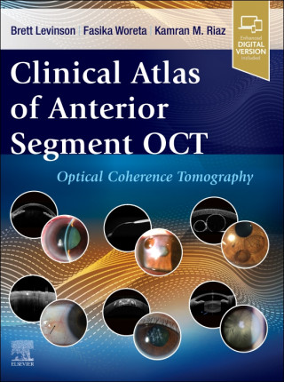 Clinical Atlas of Anterior Segment OCT: Optical Coherence Tomography (Brett Levinson,Fasika Woreta,Kamran M. Riaz)()