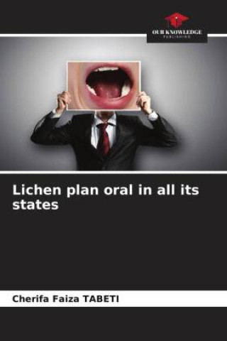 Lichen plan oral in all its states
