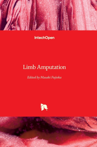 Limb Amputation