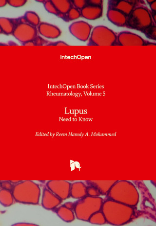 Lupus