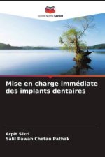 Mise en charge immédiate des implants dentaires