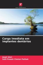 Carga imediata em implantes dentários