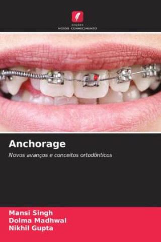 Anchorage