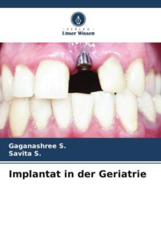 Implantat in der Geriatrie