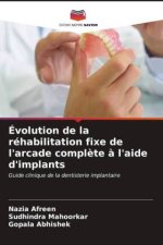 Évolution de la réhabilitation fixe de l'arcade compl?te ? l'aide d'implants