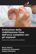 Evoluzione della riabilitazione fissa dell'arco completo con gli impianti
