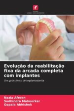 Evoluç?o da reabilitaç?o fixa da arcada completa com implantes