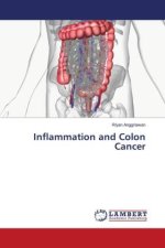 Inflammation and Colon Cancer
