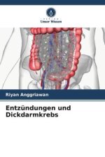 Entzündungen und Dickdarmkrebs