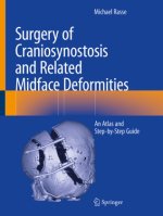Surgery of Craniosynostosis and Related Midface Deformities
