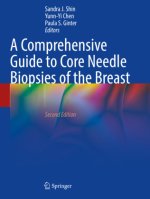 A Comprehensive Guide to Core Needle Biopsies of the Breast