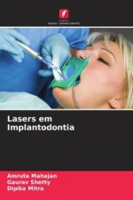 Lasers em Implantodontia