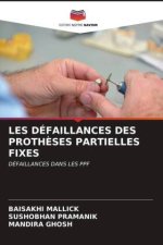 LES DÉFAILLANCES DES PROTH?SES PARTIELLES FIXES