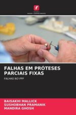 FALHAS EM PRÓTESES PARCIAIS FIXAS