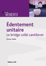 Edentement unitaire - Le bridge collé cantilever