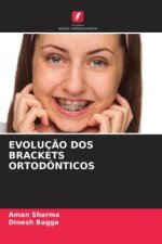 EVOLUÇ?O DOS BRACKETS ORTODÔNTICOS