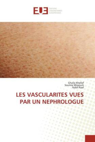 LES VASCULARITES VUES PAR UN NEPHROLOGUE