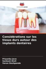 Considérations sur les tissus durs autour des implants dentaires