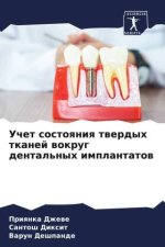 Uchet sostoqniq twerdyh tkanej wokrug dental'nyh implantatow