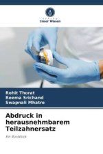 Abdruck in herausnehmbarem Teilzahnersatz